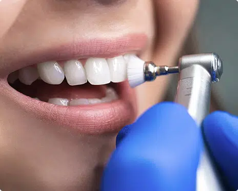Professional Dental Hygiene Treatment